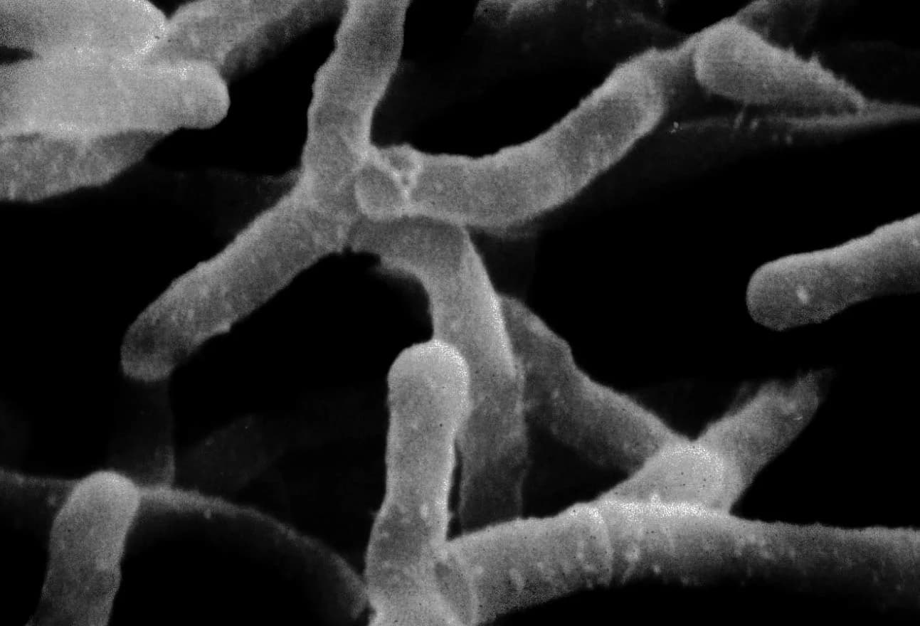 Actinomycetes
